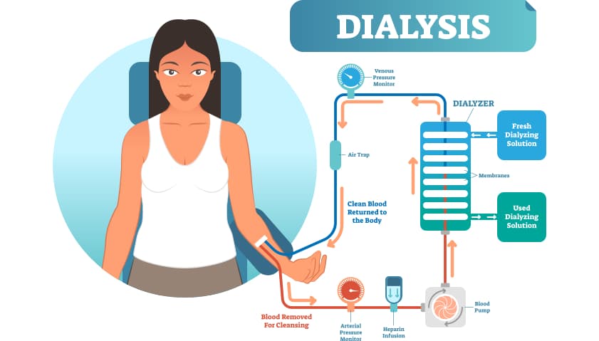 dialysis image concept
